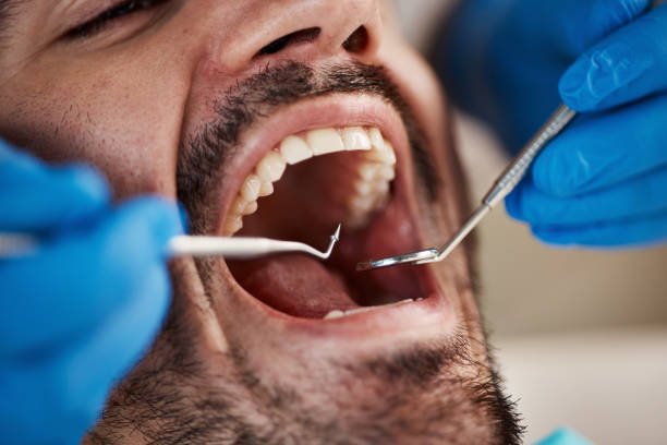 Best Mobile Emergency Dentist in Yorkvle, IL