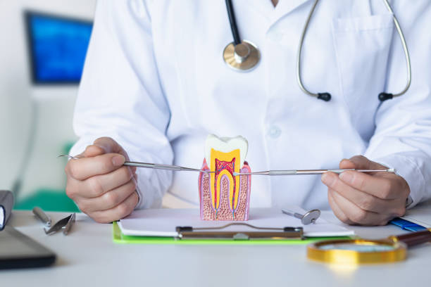 Best Emergency Root Canal Treatment in Yorkvle, IL