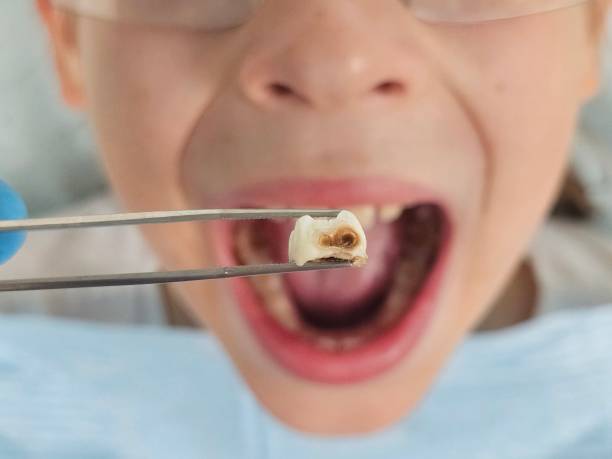 Best Orthodontic Emergency Dentist in Yorkvle, IL